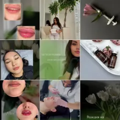 Главное фото: Сочи, Услуги, Красота и Здоровье, Косметология и уход за лицом: Косметолог - Сочи. (Все районы города Сочи и пригород (по договорённости)) - 14 ноября 2025 г. 14:19